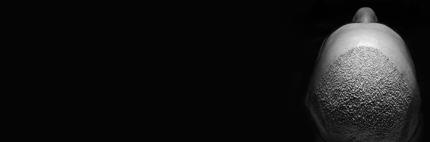 hairsure_new_banner13