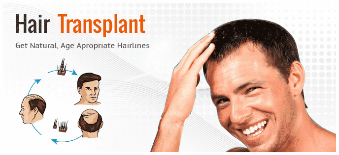 Get rid of permanent Hair loss treatment in Hyderabad, certified trichologist near me