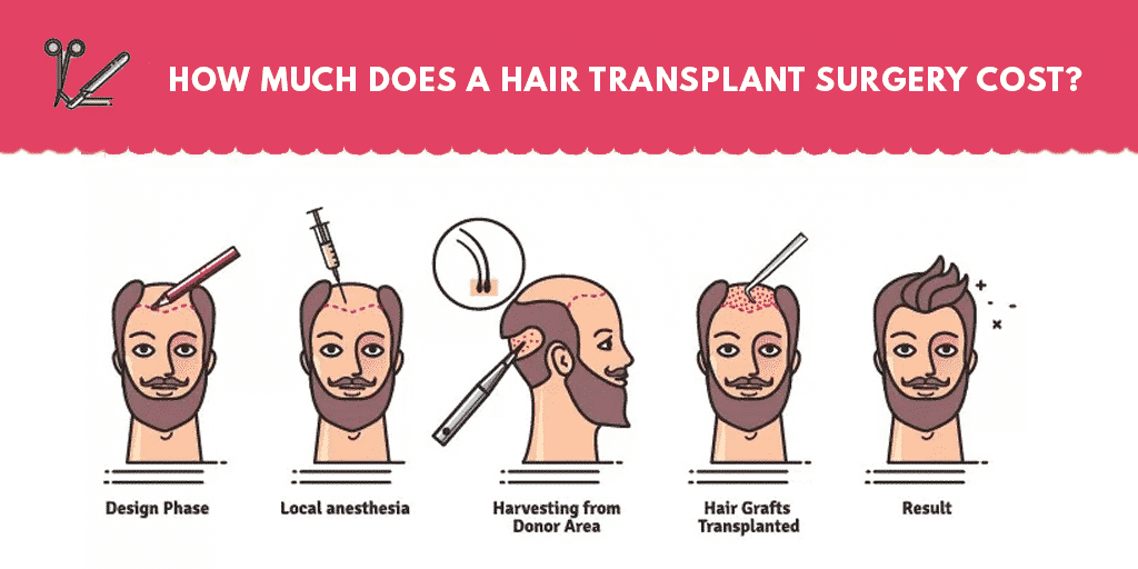 Hair transplantation cost in Hyderabad, best Hair doctor near me