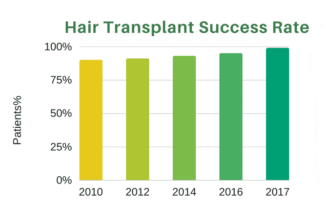 Best Success Rate Of Hair Transplant in Hyderabad, Hair loss doctor near me