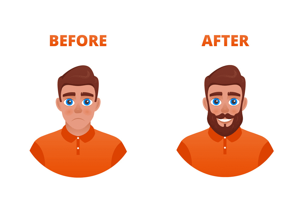 Hair fall due to Stress and Anxiety treatment in Hyderabad, best Hair doctor near me