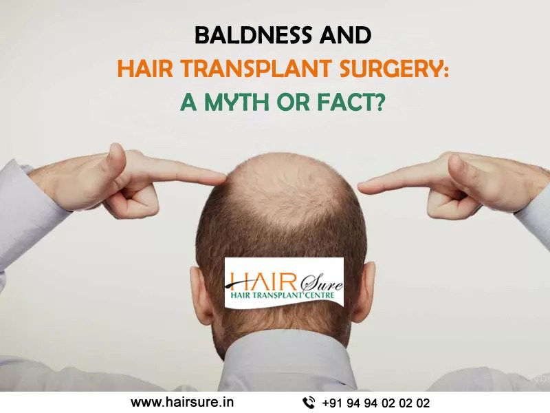 Baldness and hair transplant surgery: A myth or fact? | Hair Sure