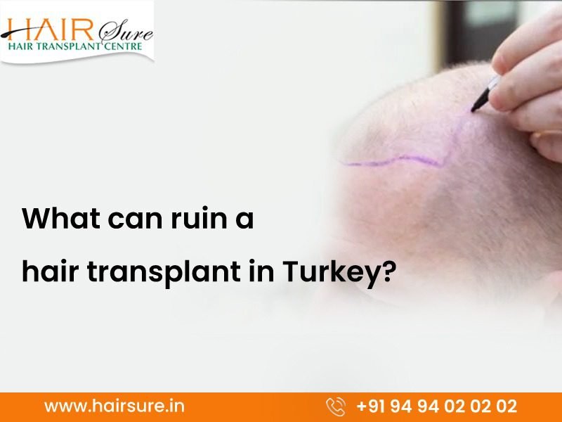 Best hair transplant clinic in Hyderabad