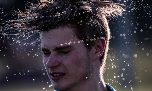 Best hair transplant clinic in Hyderabad