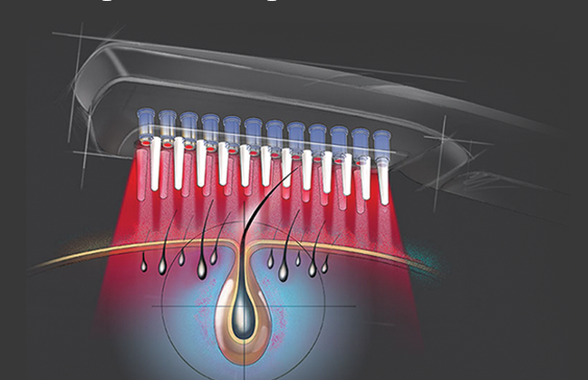 best treatment for Hair loss in Hyderabad, best Hair loss dermatologist near me