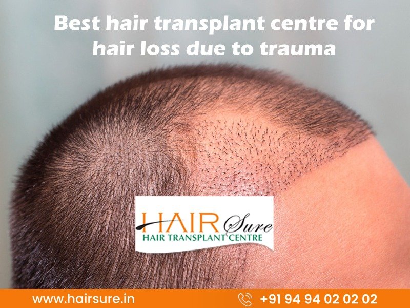 Best hair transplant clinic in Hyderabad