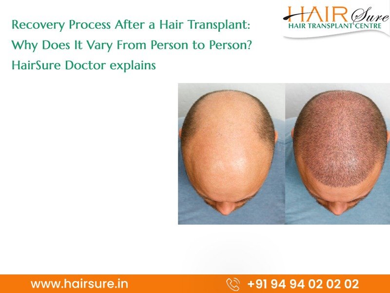 Best hair transplant clinic in Hyderabad