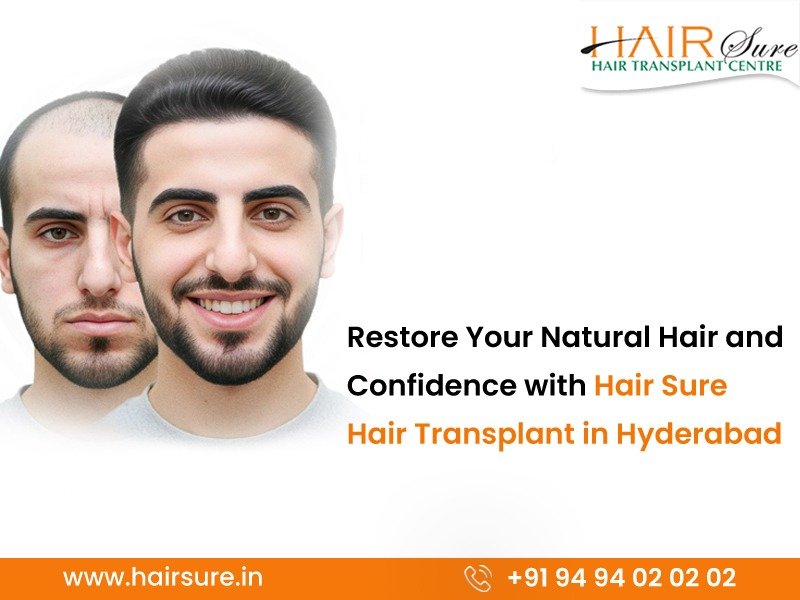 Best hair transplant clinic in Hyderabad